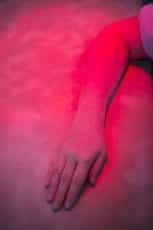Patient forearm physiotherapy rehabilitation heat lamp