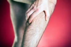 Running physical injury, leg pain