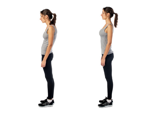 photodune-11229196-woman-with-impaired-posture-position-defect-scoliosis-and-ideal-bearing-xs